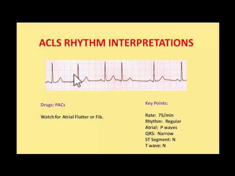 ACLS EKG Rhythms 2016 - Interpretations and managements by NIK NIKAM MD