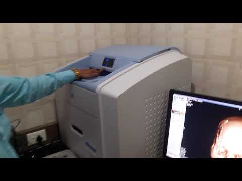 How to load xray films in konica camera/printer