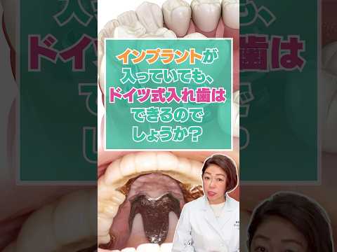 インプラントが入っていても、ドイツ式入れ歯はできるのでしょうか？