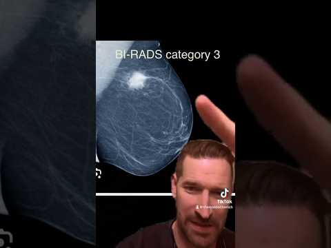 Bi-Rads Mammographie-Bewertungen! #Frauengesundheit #drrich #doctorrich #obgyn #mammogram #breast...