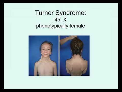 Genetics Chapter 4 Part 1