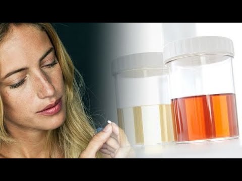 A është e dëmshme sasia e tepërt e vitaminës B12?