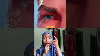 Download lagu matanya memerah #science #facts #shortvideo #filmpendek #ceritainspiratif #storytelling #obatmata mp3