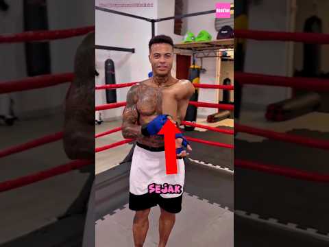 Tangan petinju ini patah sejak ia kecil‼️ #shorts