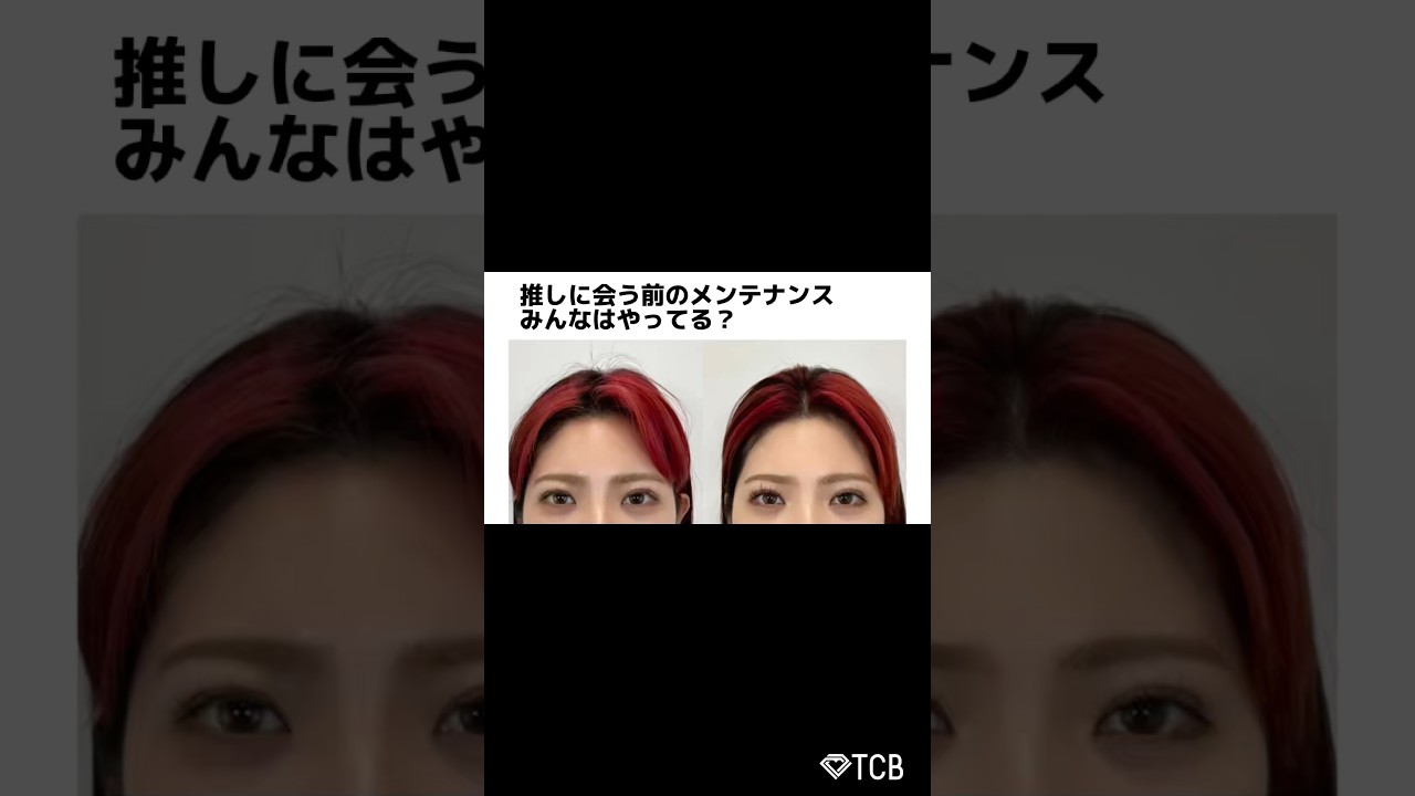 【糸リフト】推しに会う前のメンテナンス #shorts