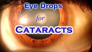 Lanosterol Eye Drops can cure Cataract without Surgery