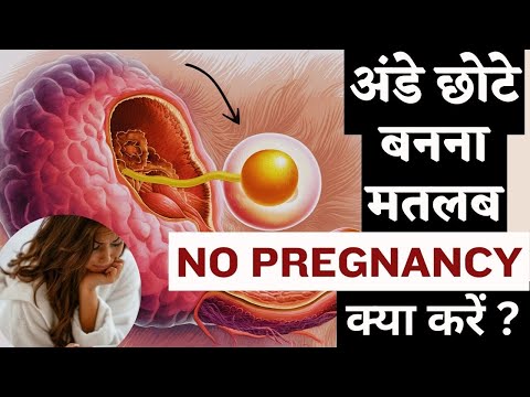 अंडे छोटे बनना मतलब NO PREGNANCY क्या करे - Small Egg size & fertility tips #prernafertilitycare