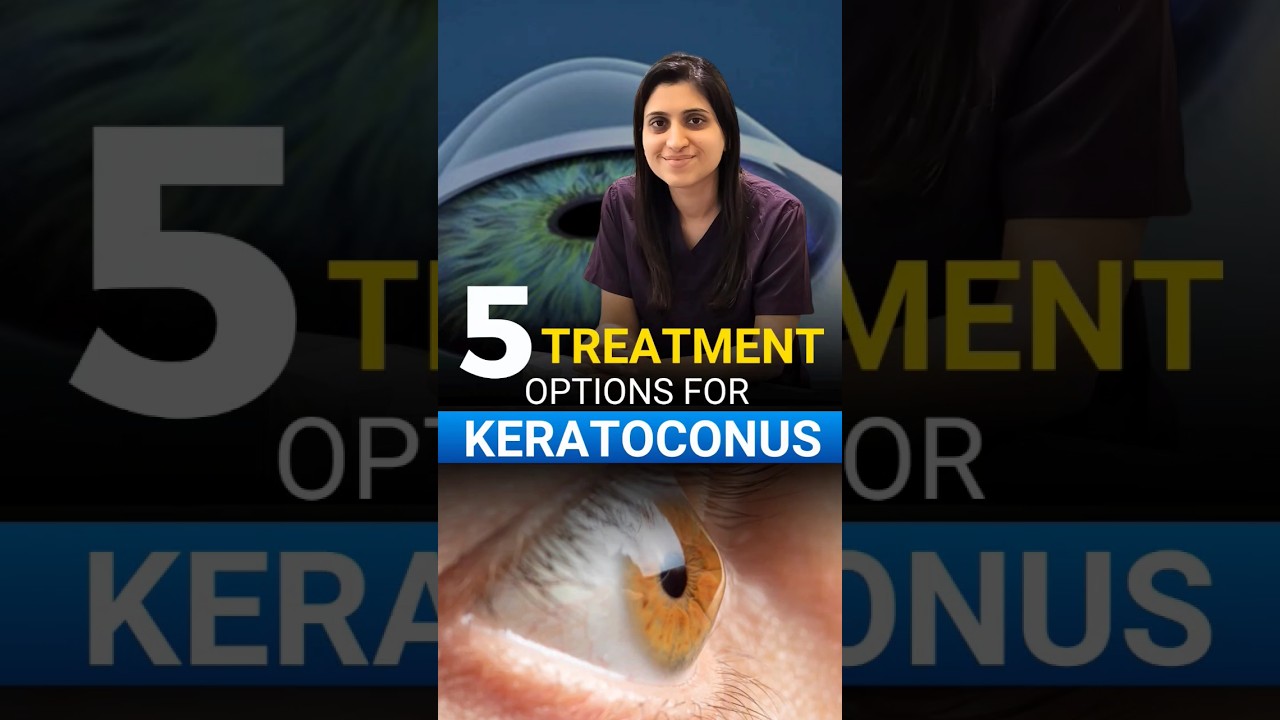 5 Treatment Options For Keratoconus