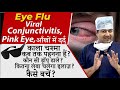 Dr Rahil Speaks on Eye Flu - Conjunctivitis : Myths, Causes, Symptoms, Precautions and Treatments