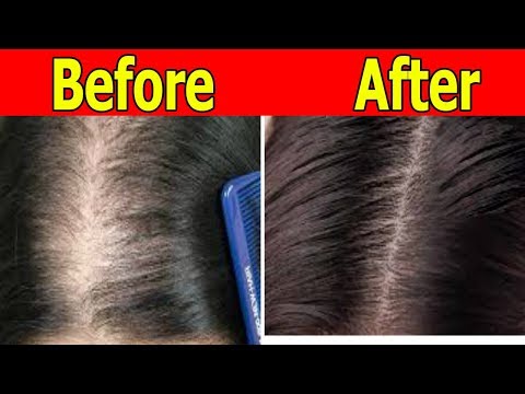 Green coffee presyo Turboslim review Mabilis na pagbaba ng timbang kepe diyeta