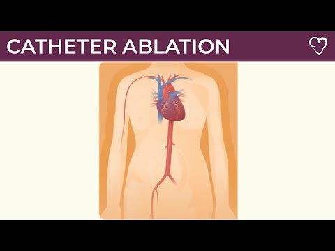 Catheter Ablation