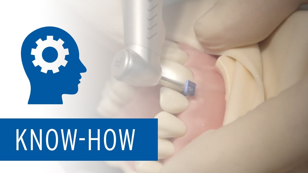 Zolid Preparation Dent Kit – Frontzahnpräparation