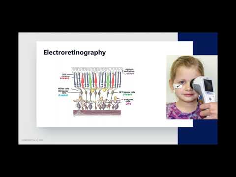 Pediatric ERG testing with the RETeval® device—w/o sedation or corneal electrode—Victor Pegado, MD