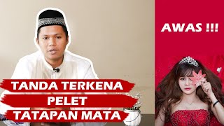 Download lagu Penyebab Orang Mudah Terkena Pelet Tatapan Mata mp3