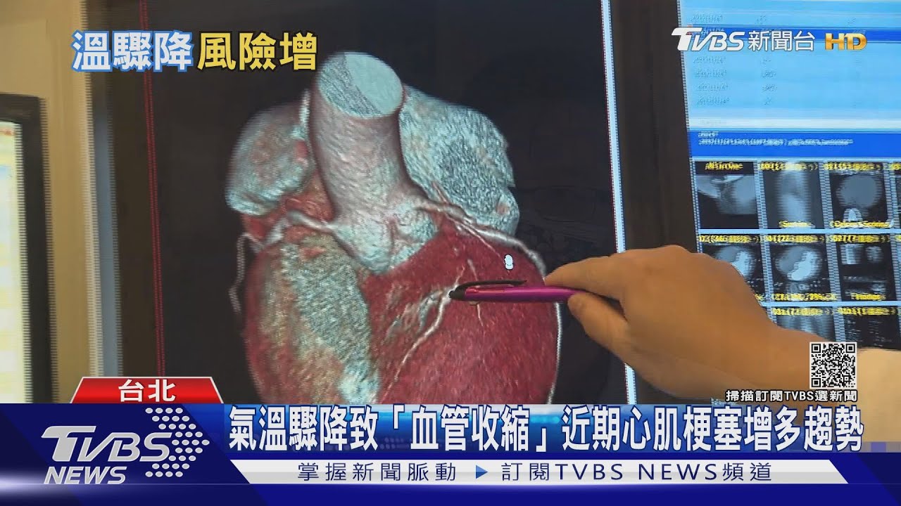 輕忽三高!天冷血管收縮!易「心肌梗塞」 醫師警告注意這件事