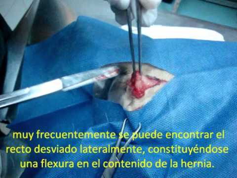Dolore persistente al collo nella parte posteriore della La diagnosi di lesione della colonna vertebrale cervicale