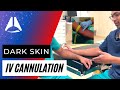 IV Cannulation of dark skin & what I do when I mess up | #ivcannulation #anesthesia #anesthesiology