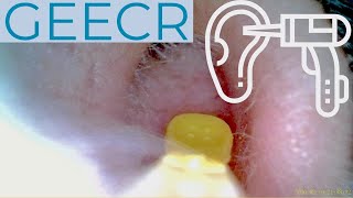 CLEAN YOUR EARS! Use The GEECR Otoscope To Inspect And Clean Your Own Ears!