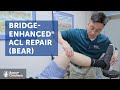 Bridge Enhanced ACL Repair BEAR Boston Children S Hospital