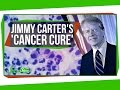 Jimmy Carter's 'Cancer Cure'