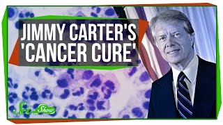 Jimmy Carter's 'Cancer Cure'