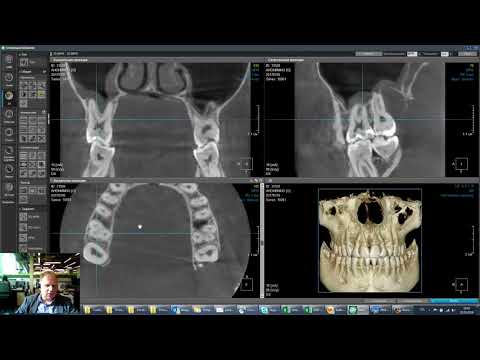 Наклонная проекция в OnDemand3D Dental