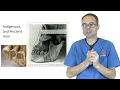The Cause And Cure Of Bruxism And Clenching By Dr Mike Mew