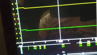 2007 Ram 1500 4x4 C1404 Code