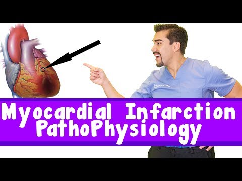 Myocardial Infarction pathophysiology