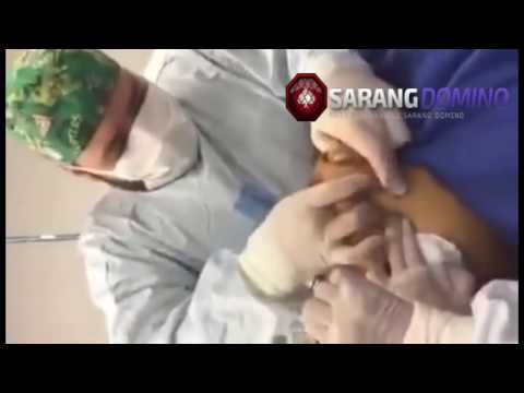 Luka kecil pada penis Potensi alkohol ginjal