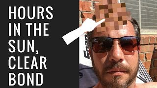 Hair Replacement Hair System Review Hours in the Sun!! Clear Bond