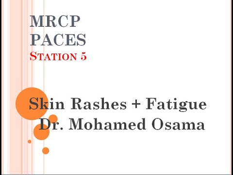 MRCP- PACES - Station 5 - Skin Rashes + Fatigue - Dr. Mohamed Osama