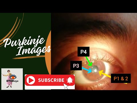 Purkinje Images || Catoptric Images || Reflections from the Normal Phakic Eyes