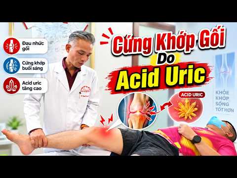 Gối Cứng Sau Chạy Bộ Không Chỉ Do Chạy, Còn Do Acid Uric