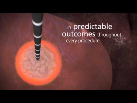 Covidien Emprint Ablation System with Thermosphere Technology