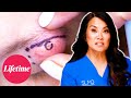 Dr Lee Removes A HUGE Cyst Near A Patient S Eye Dr Pimple Popper Breaking Out S1 Lifetime