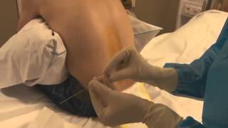 VUmc afdeling hematologie: lumbaalpunctie