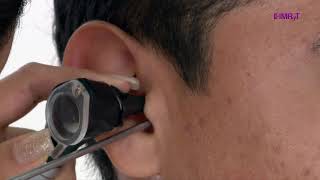 Limpieza de oídos- Vida Saludable