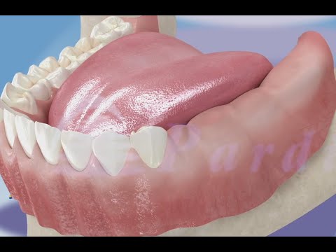 가이드가 있는 뼈의 재생성 ©