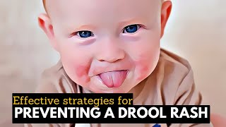 From Irritation to Radiant Skin: Managing Drool Rash with Care