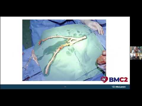 "Aortic Graft Infections" by Dr. Nicolas J. Mouawad