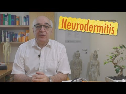 Atopitscheski die Hautentzündung das Ekzem als zu behandeln Der Strahl des Bibers vom Ekzem