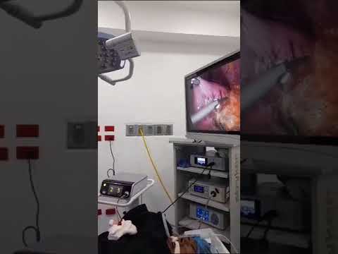 Cirugía para la obesidad Barranquilla por Moreno Sirtori Cirugía Bariátrica y Laparoscópica