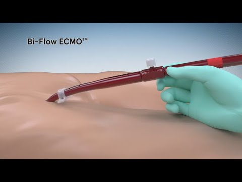 Bi-Flow bidirectional cannula. Medical device animation by Aarons CGI 3D animation studio Melbourne