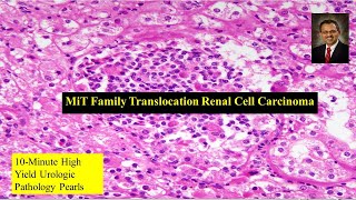 Download Lagu MiT Family Translocation Renal Cell Carcinoma Thumbnail