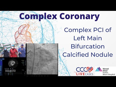 Complex PCI of Left Main Bifurcation Calcified Nodule