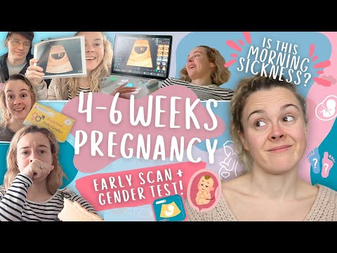 EARLY SCAN, Sneak Peek GENDER TEST... And morning sickness already?!  (The Baby Diaries: Chapter 4)
