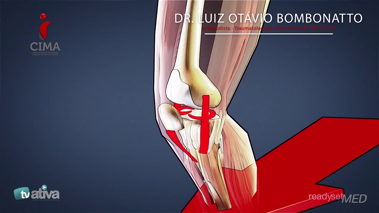 Luiz Otávio Bombonatto-5