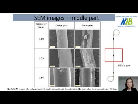 The influence of polyurethane double-J stent of various diameters on urological encrustation