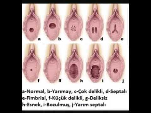 QIZLIK PARDASI. Doktor Sohib 909438473